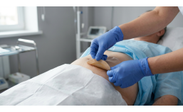 Как снять калоприемник без боли и повреждения кожи